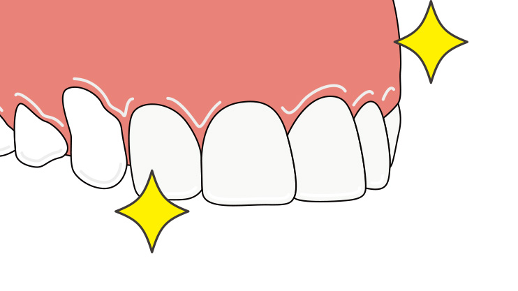 治療完了の様子イメージイラスト